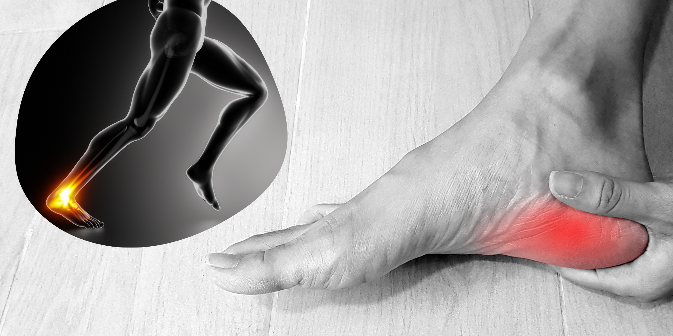 Heel Pain from Running - 5 Common Types and Causes